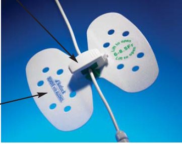 StatLock® Plus VUPD68 - Each - VUPD68